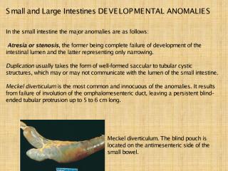 Small and Large Intestines.pdf